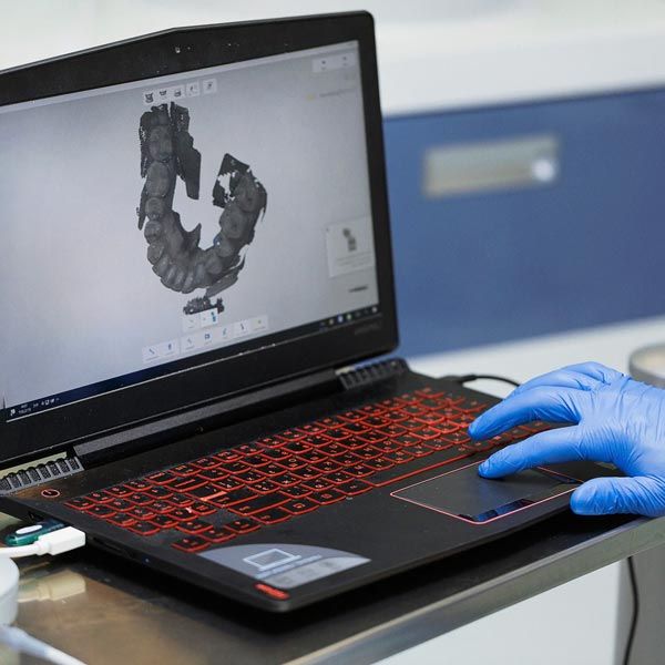 Blue gloved hand using laptop